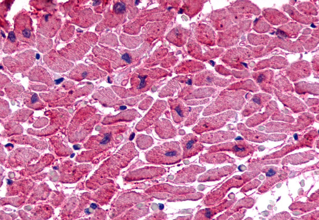 TPRA1 Antibody in Immunohistochemistry (Paraffin) (IHC (P))