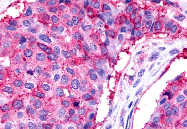 TPRA1 Antibody in Immunohistochemistry (Paraffin) (IHC (P))