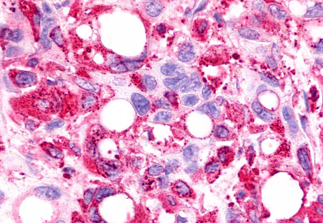 TPRA1 Antibody in Immunohistochemistry (Paraffin) (IHC (P))