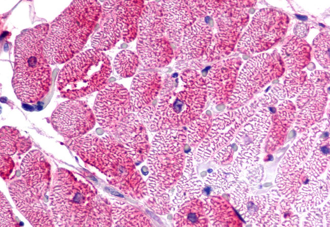 TPRA1 Antibody in Immunohistochemistry (Paraffin) (IHC (P))