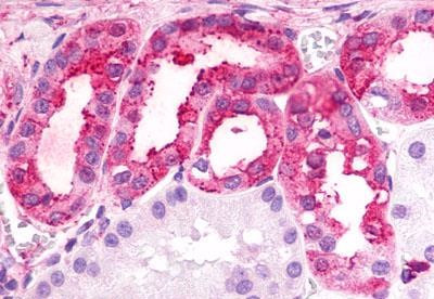 TPRA1 Antibody in Immunohistochemistry (Paraffin) (IHC (P))