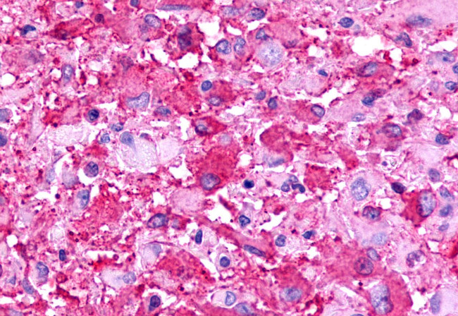 TPRA1 Antibody in Immunohistochemistry (Paraffin) (IHC (P))