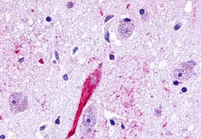 TPRA1 Antibody in Immunohistochemistry (Paraffin) (IHC (P))