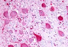 TPRA1 Antibody in Immunohistochemistry (Paraffin) (IHC (P))