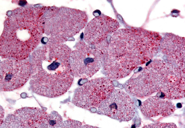 TPRA1 Antibody in Immunohistochemistry (Paraffin) (IHC (P))