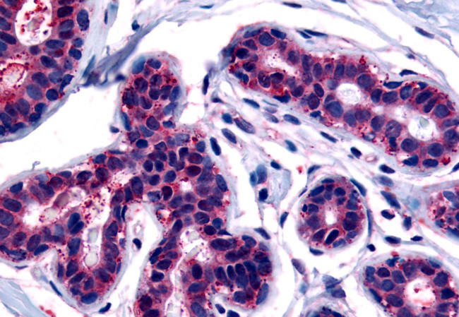 TRIB3 Antibody in Immunohistochemistry (Paraffin) (IHC (P))