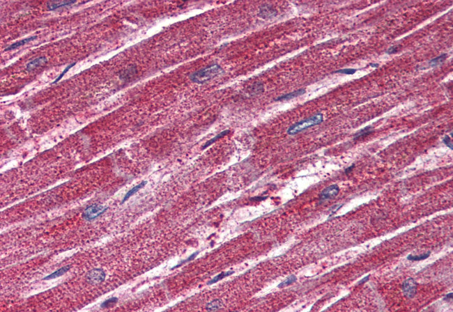 TRPM4 Antibody in Immunohistochemistry (Paraffin) (IHC (P))