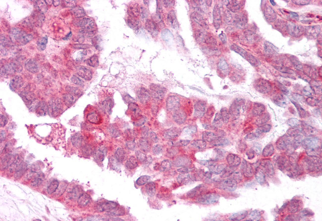 TRPM4 Antibody in Immunohistochemistry (Paraffin) (IHC (P))