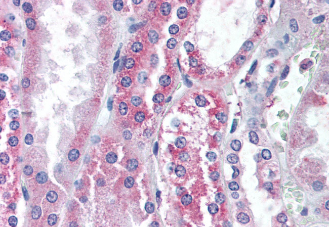 TRPV1 Antibody in Immunohistochemistry (Paraffin) (IHC (P))