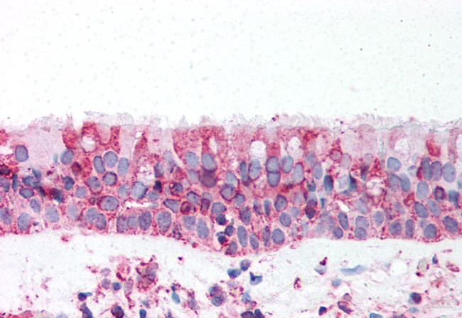 TRPV4 Antibody in Immunohistochemistry (Paraffin) (IHC (P))