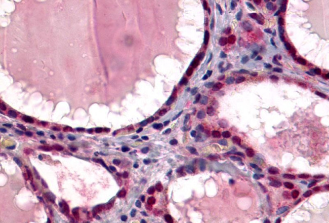 TSH Receptor Antibody in Immunohistochemistry (Paraffin) (IHC (P))