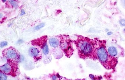 Urotensin II Receptor Antibody in Immunohistochemistry (Paraffin) (IHC (P))