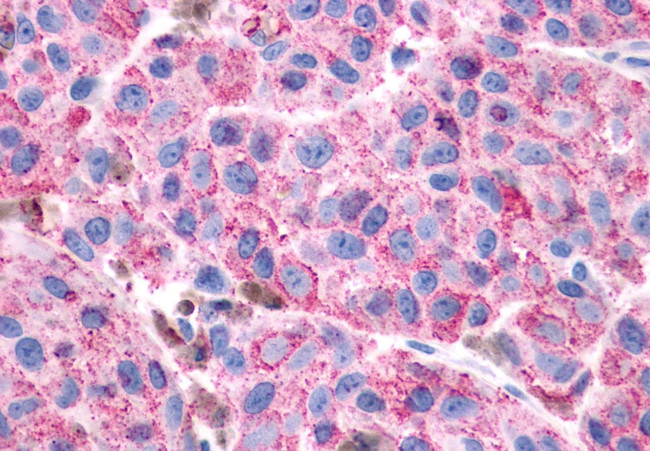 VIPR1 Antibody in Immunohistochemistry (Paraffin) (IHC (P))