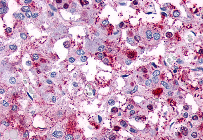 VIPR1 Antibody in Immunohistochemistry (Paraffin) (IHC (P))