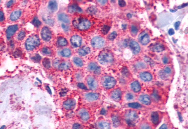 VIPR1 Antibody in Immunohistochemistry (Paraffin) (IHC (P))