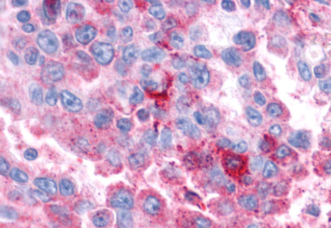 VIPR1 Antibody in Immunohistochemistry (Paraffin) (IHC (P))