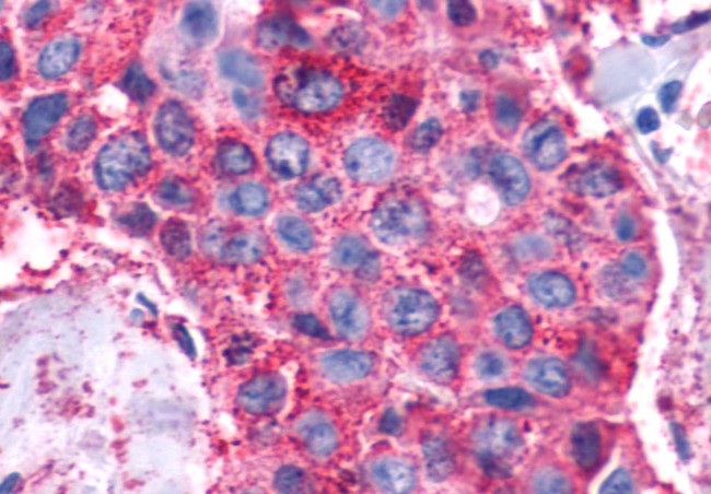 VIPR1 Antibody in Immunohistochemistry (Paraffin) (IHC (P))