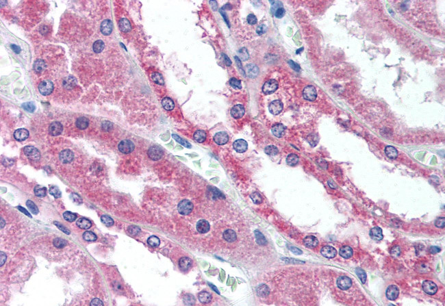 WNT1 Antibody in Immunohistochemistry (Paraffin) (IHC (P))