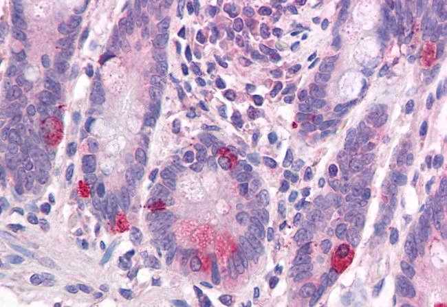 WNT1 Antibody in Immunohistochemistry (Paraffin) (IHC (P))