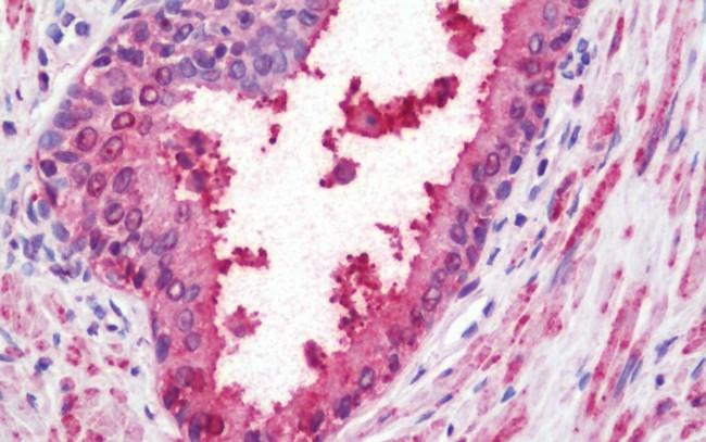 WNT10A Antibody in Immunohistochemistry (Paraffin) (IHC (P))