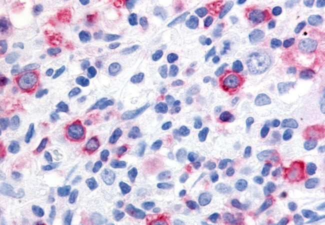 WNT10A Antibody in Immunohistochemistry (Paraffin) (IHC (P))