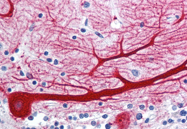 WNT10B Antibody in Immunohistochemistry (Paraffin) (IHC (P))