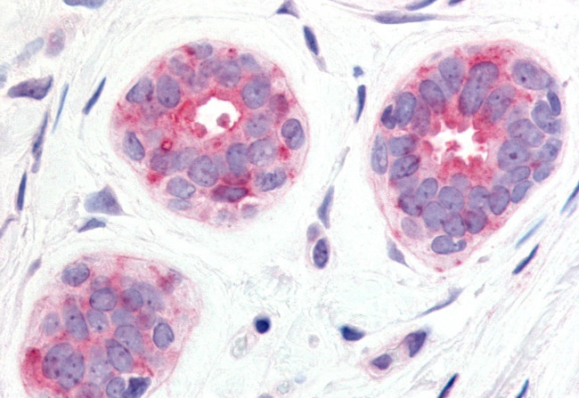 WNT6 Antibody in Immunohistochemistry (Paraffin) (IHC (P))