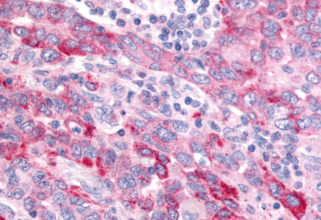 WNT8A Antibody in Immunohistochemistry (Paraffin) (IHC (P))