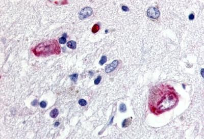 WNT8A Antibody in Immunohistochemistry (Paraffin) (IHC (P))