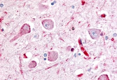 WNT8A Antibody in Immunohistochemistry (Paraffin) (IHC (P))