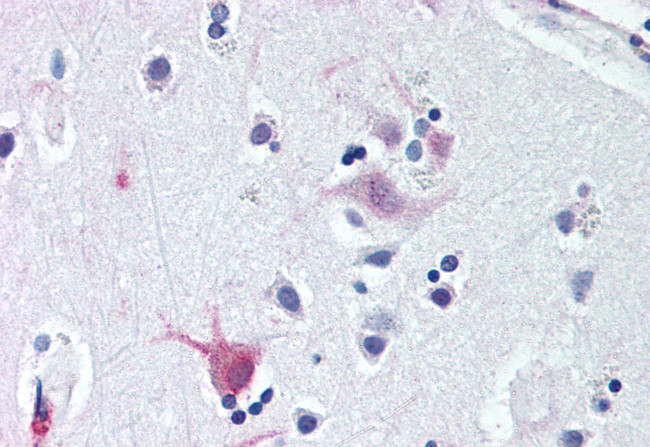 WNT8B Antibody in Immunohistochemistry (Paraffin) (IHC (P))