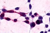 XPR1 Antibody in Immunocytochemistry (ICC/IF)