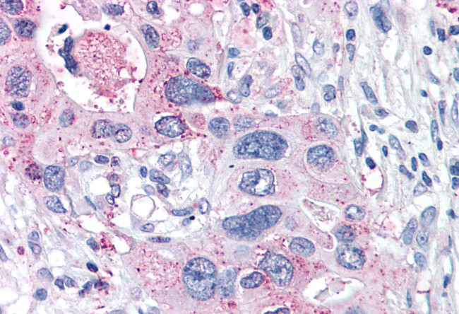 XPR1 Antibody in Immunohistochemistry (Paraffin) (IHC (P))