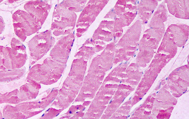 XPR1 Antibody in Immunohistochemistry (Paraffin) (IHC (P))