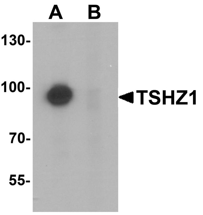 TSHZ1 Antibody in Western Blot (WB)