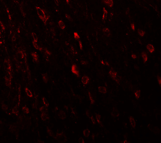 TSHZ3 Antibody in Immunohistochemistry (IHC)