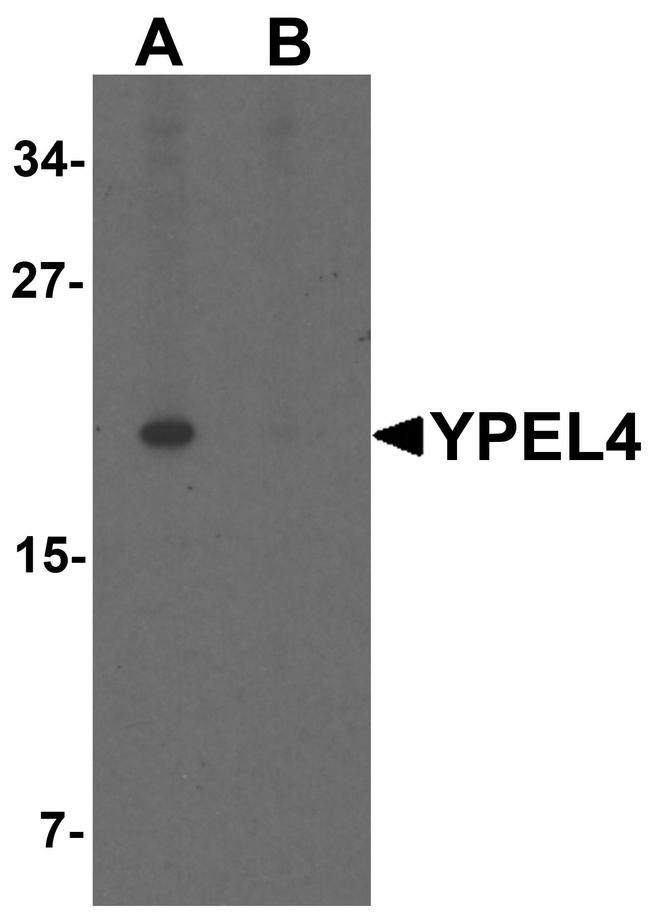 YPEL4 Antibody in Western Blot (WB)