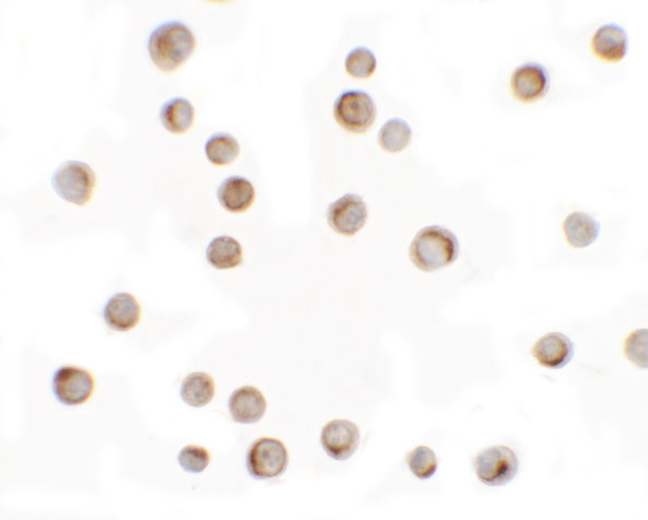 RILP Antibody in Immunocytochemistry (ICC/IF)