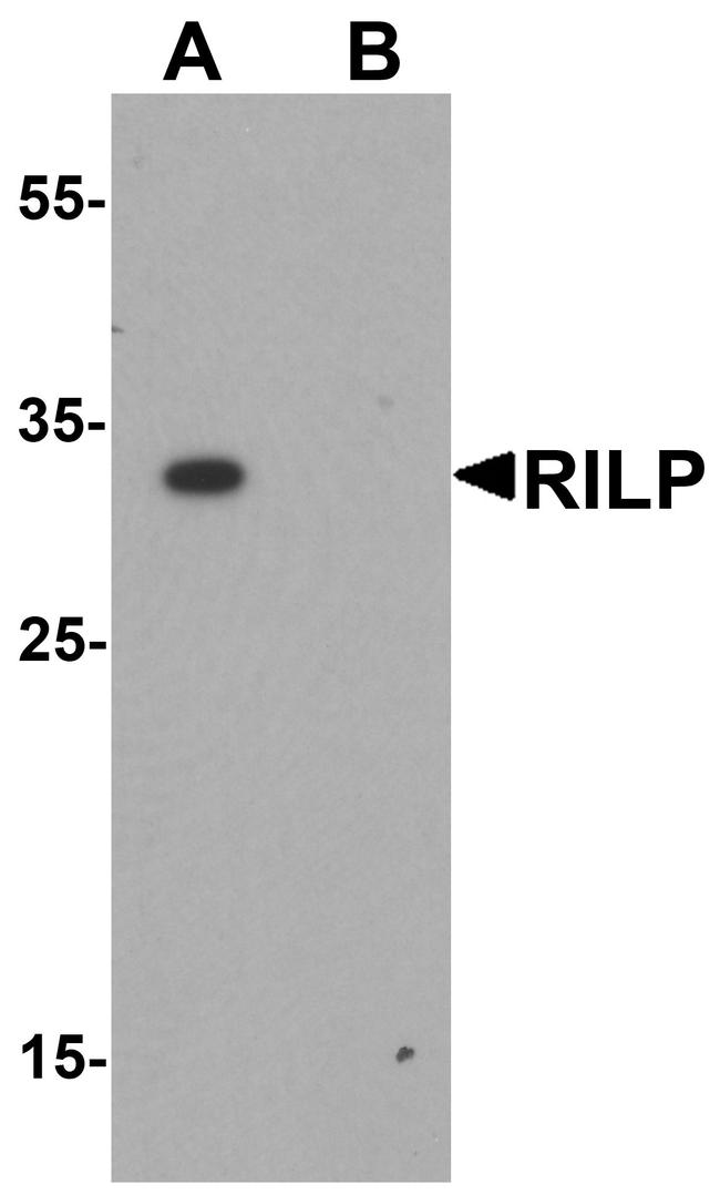 RILP Antibody in Western Blot (WB)