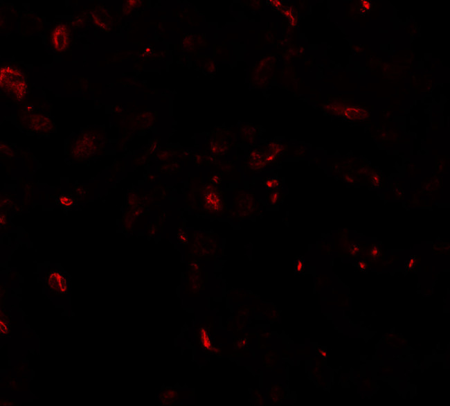 TFEB Antibody in Immunohistochemistry (IHC)