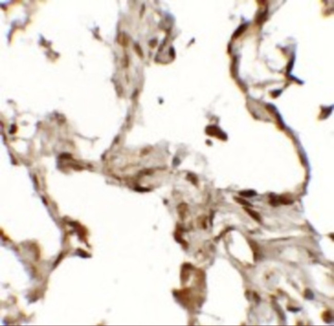 TFEB Antibody in Immunohistochemistry (IHC)