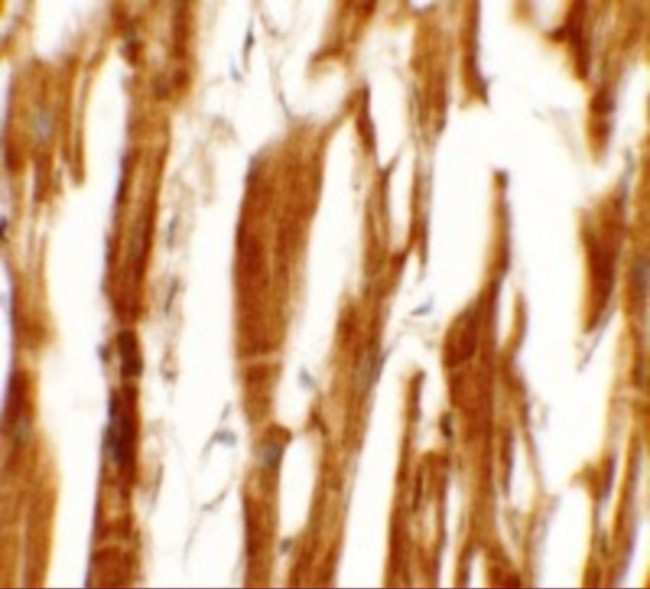 ESRRB Antibody in Immunohistochemistry (IHC)