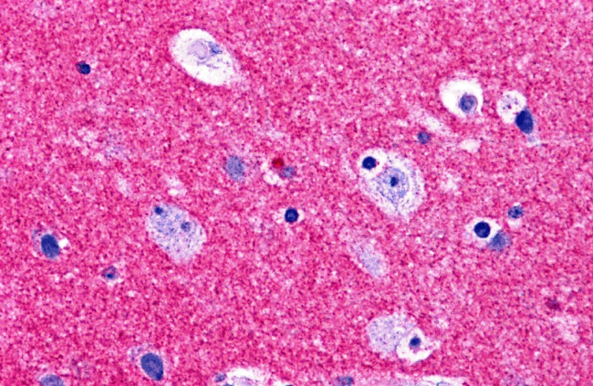 RIM2 Antibody in Immunohistochemistry (IHC)