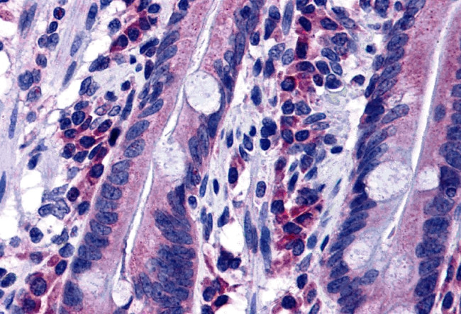 IQGAP1 Antibody in Immunohistochemistry (IHC)