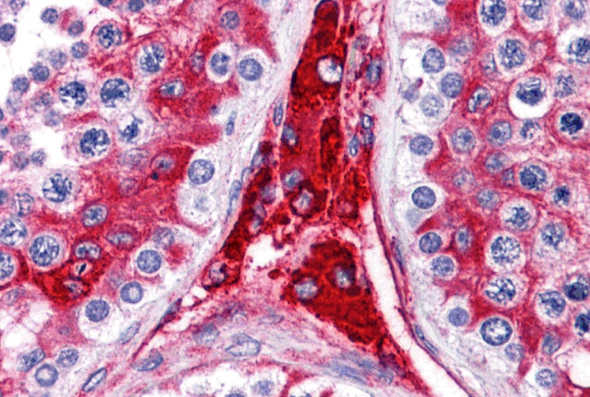 WDR35 Antibody in Immunohistochemistry (IHC)