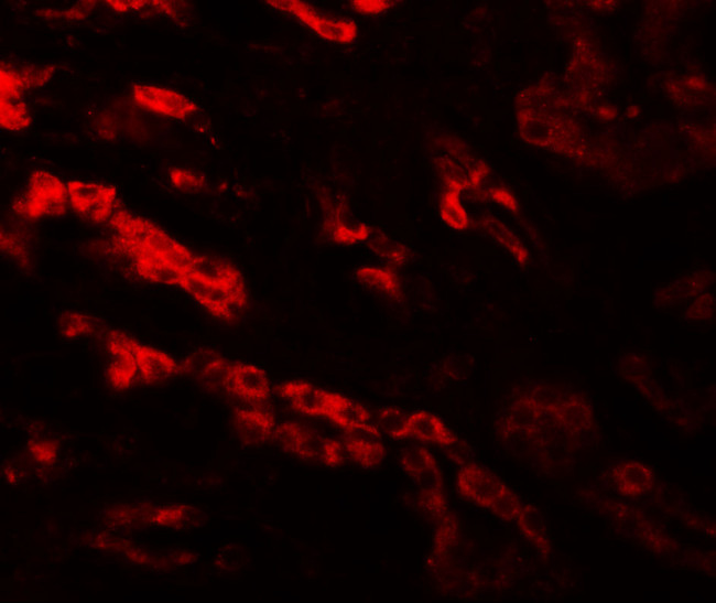 GZF1 Antibody in Immunohistochemistry (IHC)