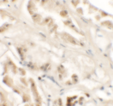 GZF1 Antibody in Immunohistochemistry (IHC)