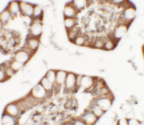 ZFX Antibody in Immunohistochemistry (IHC)