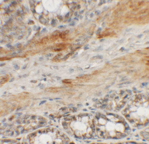 CCP110 Antibody in Immunohistochemistry (IHC)