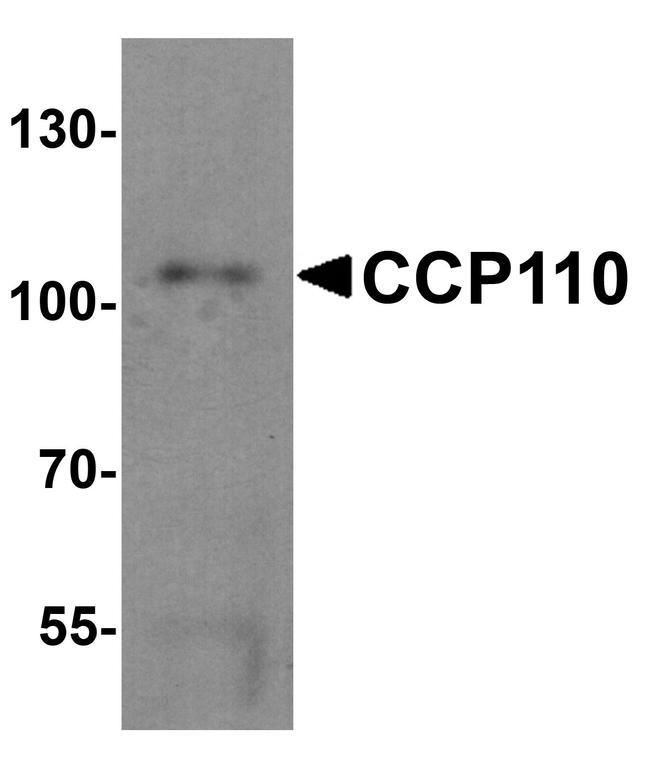 CCP110 Antibody in Western Blot (WB)